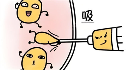 吸脂術(shù)動(dòng)畫(huà)
