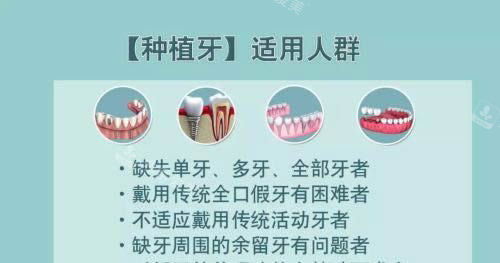 韩国登特4