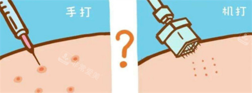 手打水光和機(jī)打水光的區(qū)別圖解 手打水光和機(jī)打水光的區(qū)別圖解