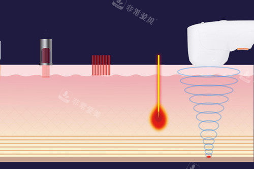 不同光電項(xiàng)目作用層次示意圖