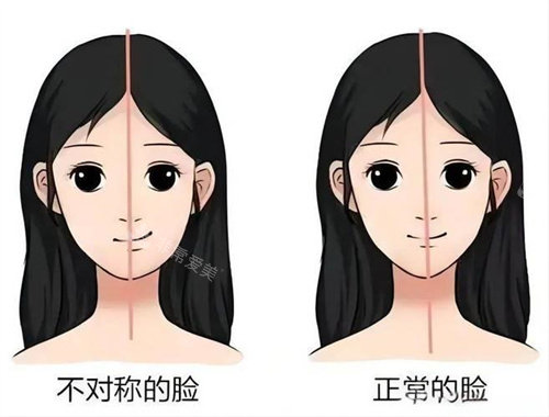 面部不對(duì)稱與正常的臉對(duì)比動(dòng)畫圖 面部不對(duì)稱與正常的臉對(duì)比動(dòng)畫圖