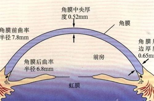 圆锥角膜数据分析图解
