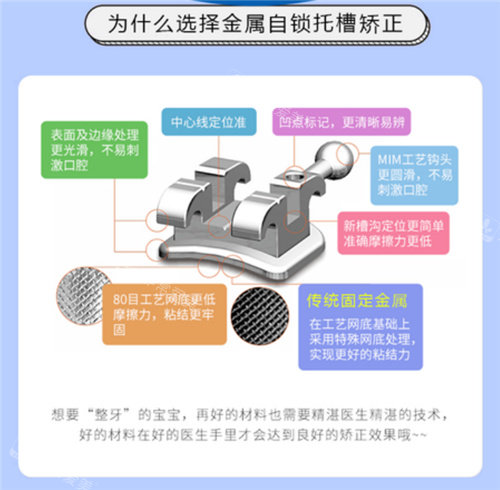 金属自锁托槽矫正透视