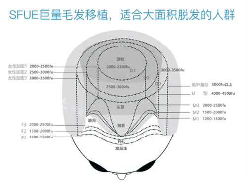 济南熙朵头发移植医院地址简介资料分享!路线,收费,技术多元化解析~