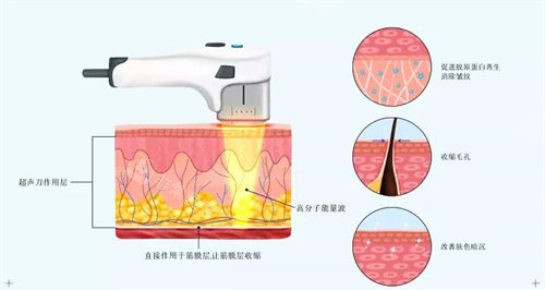 超声炮原理