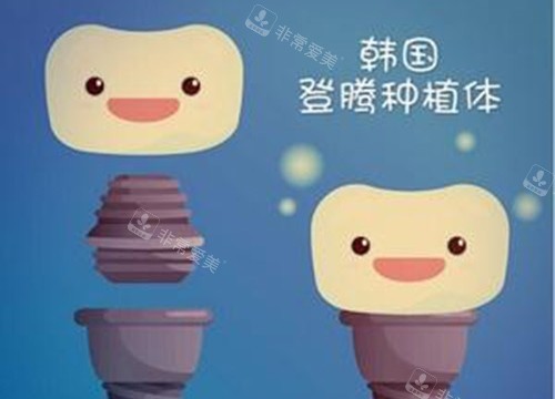 登腾种植体
