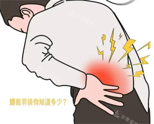 腰肌勞損導(dǎo)致疼痛 腰肌勞損導(dǎo)致疼痛