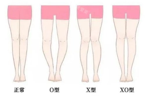 腿型卡通對(duì)比圖 腿型卡通對(duì)比圖
