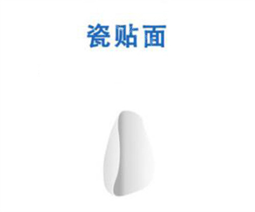 瓷貼面修復改善圖 瓷貼面修復改善圖