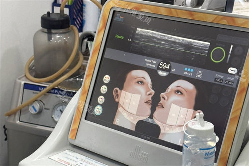 鈦提升設(shè)備操作中 鈦提升設(shè)備操作中