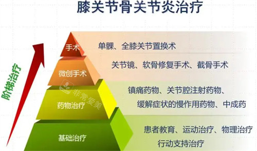 關(guān)節(jié)炎治療方式 關(guān)節(jié)炎治療方式