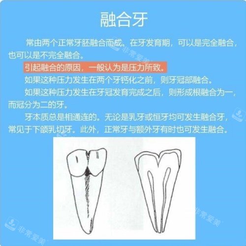 融合牙介紹示意圖