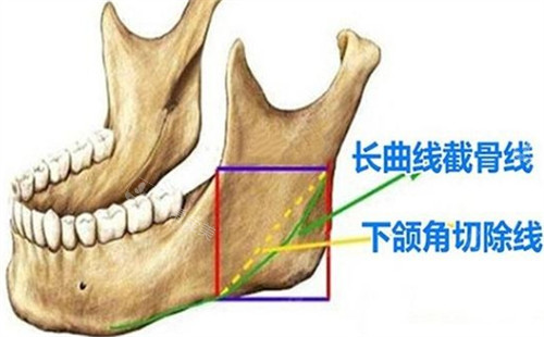 下颌角所在位置