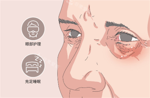 眼部護(hù)理
