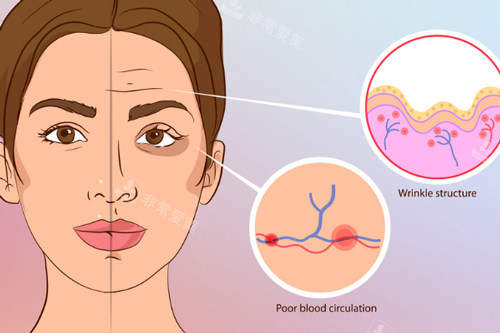 韩国some clinic打卧蚕和嘴巴口碑好,暧昧some皮肤科玻尿酸价格40万韩币起