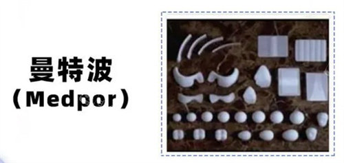 曼特波超肋骨