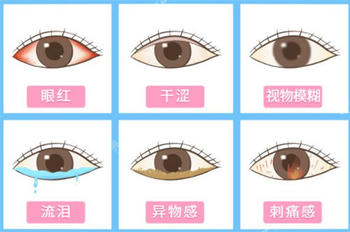 干眼症症状