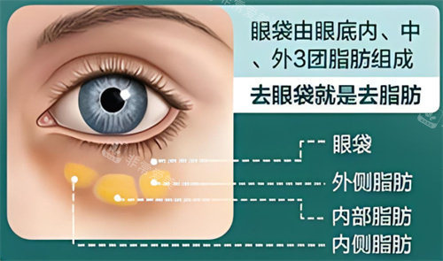 去眼袋原理 去眼袋原理