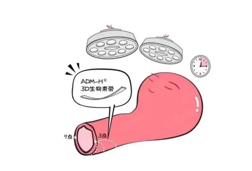 3d生物束带缩阴