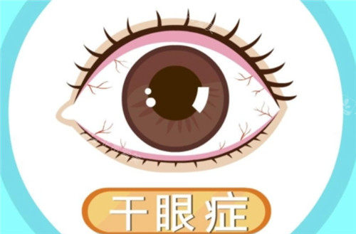 干眼症眼球照片
