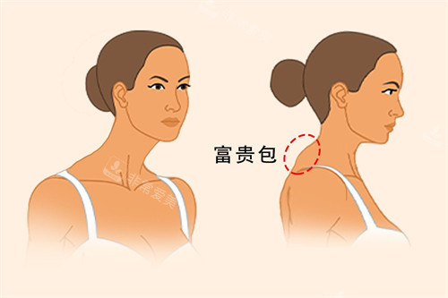 富贵包动画展示图 富贵包动画展示图