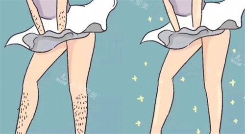 脫毛前后對(duì)比圖 脫毛前后對(duì)比圖