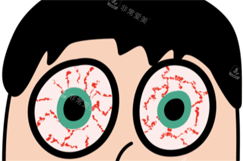 干眼症动画图