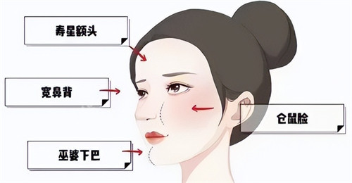 饅化臉韓國(guó)修復(fù)技術(shù)非常好，玻尿酸溶解后我終于找回了自己！