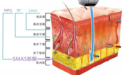 超聲炮激光作用原理