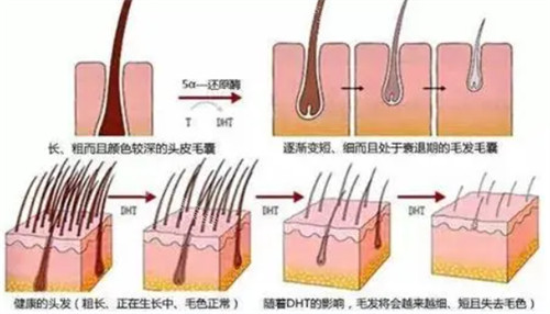 毛囊的不同健康情況