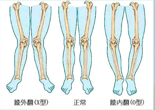 不同腿型對比動畫演示 不同腿型對比動畫演示