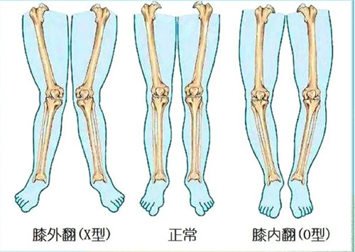 不同腿型對比動(dòng)畫演示