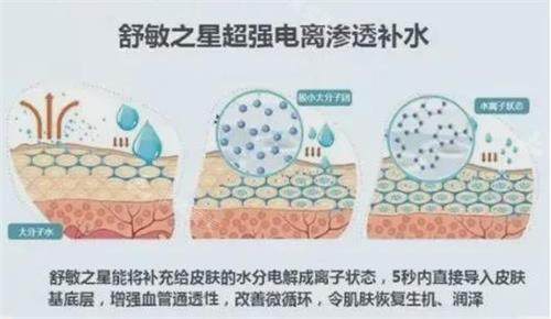 舒敏之星原理