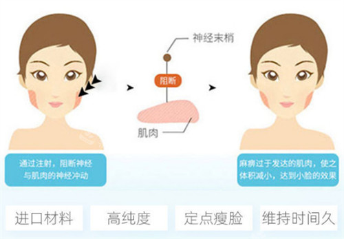 注射瘦臉的作用圖解 注射瘦臉的作用圖解