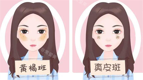 不同斑點(diǎn)的樣子圖片 不同斑點(diǎn)的樣子圖片