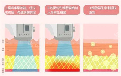 超聲波原理 超聲波原理