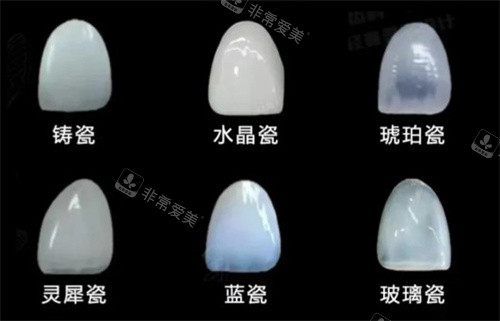 牙貼面材料 牙貼面材料