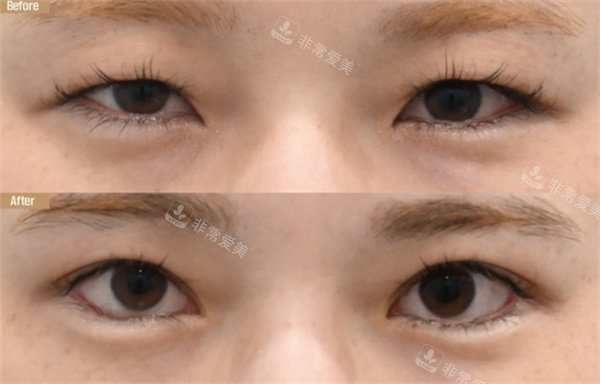 韩国21整形外科医院对比