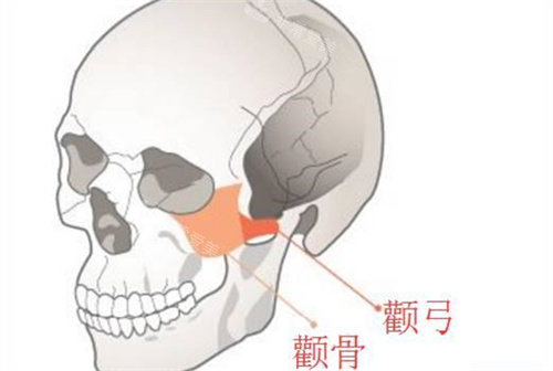 顴骨與顴弓位置動畫圖