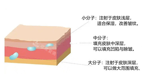 注射層次