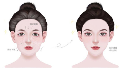 幼態(tài)臉前后緊致度對(duì)比 幼態(tài)臉前后緊致度對(duì)比