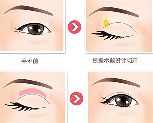 全切設(shè)計圖 全切設(shè)計圖