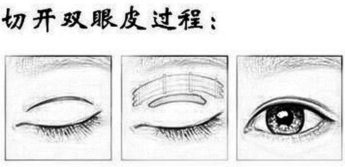 【上海眼部整形审美好的医生名单合集三】张怀军/管果/胡晓龙是行业内受认可的眼整形医生！