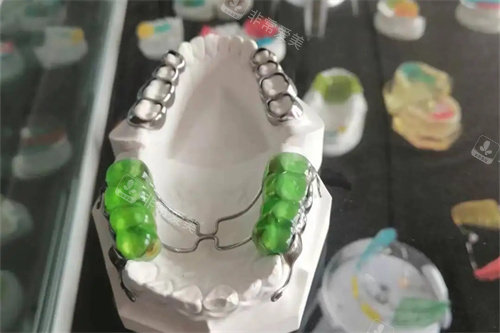 反颌牵引器实物展示图