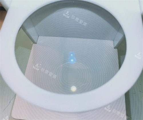 蔡司小乐圆镜片