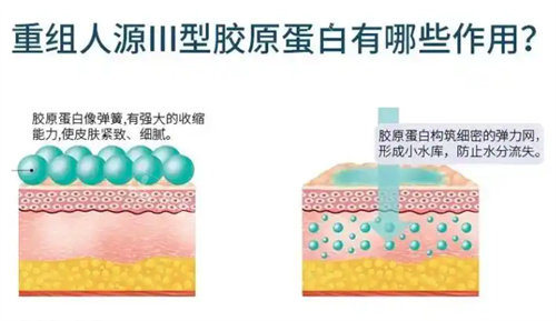 重組三型膠原蛋白有哪些作用 重組三型膠原蛋白有哪些作用