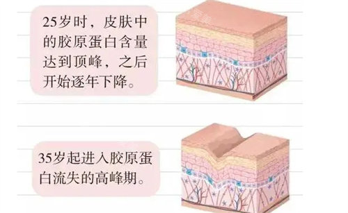 膠原蛋白的變化 膠原蛋白的變化