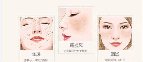 韩国EY皮肤科怎么样好不好，整友评价面部抗衰/皮肤美容技术很不错！