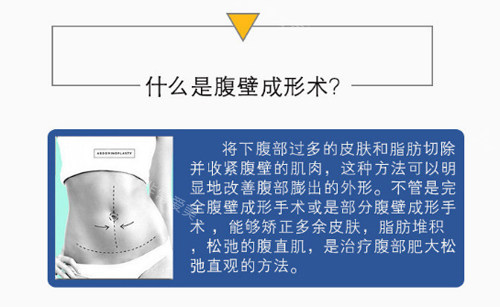 腹壁成形術(shù)原理 腹壁成形術(shù)原理