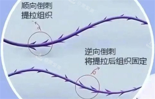 倒刺形狀線材樣子圖解 倒刺形狀線材樣子圖解